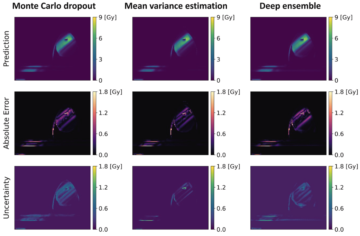 Uncertainty estimation for reliable neural network-based radiotherapy dose modelling using Monte Carlo dropout, mean variance estimation and deep ensemble